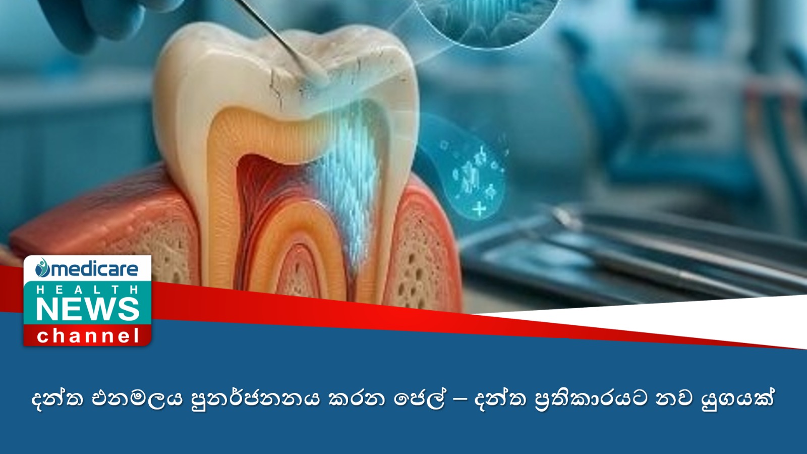 දන්ත එනමලය පුනර්ජනනය කරන ජෙල් – දන්ත ප්‍රතිකාරයට නව යුගයක්